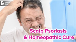 SCALP PSORIASIS  Causes Symptoms amp BEST HOMEOPATHIC REMEDY  Dr Rashmi K  Doctors Circle [upl. by Hubie]