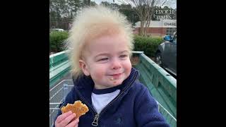 Boy With Rare Uncombable Hair Syndrome Brings a Smile to Faces [upl. by Nolrac]