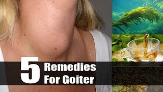 5 Useful Home Remedies For Goiter  By Top 5 [upl. by Besnard286]