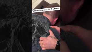 Tailbone amp Backbone pain treatment via chiropractic tailbonepain tailbonepaintreatment coccyxpa [upl. by Mchale]