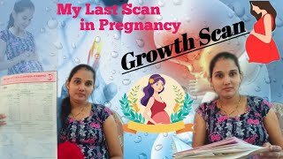 What is Growth scan  My Last Scan Experience suger CBC testbaby underweight😭 pregnancy youtube [upl. by Anan271]