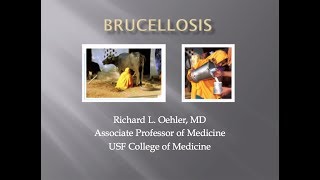 Brucellosis  Richard Oehler MD [upl. by Tterraj]