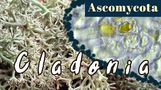 Cladonia arbuscula under the Microscope Mosslike lichensAscomycota [upl. by Notlem]