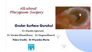 All about Pterygium SurgeryAnimated [upl. by Cordi]