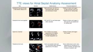 Atrial Septal Defect Primum Echocardiography [upl. by Sirrad]