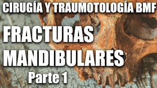 Cirugía y Traumatología Fracturas Mandibulares FOUBA parte 1 [upl. by Possing785]