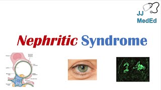 Nephritic Syndrome  Clinical Presentation Causes and Treatment [upl. by Ayitahs]