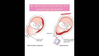 Quick quiz time obstetrician medicalstudents [upl. by Nnylyoj]