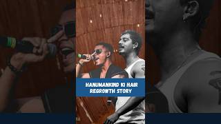 Hair line regrowth Hanumankind  Hair loss  Hair fall hair damage viral shorts [upl. by Jdavie]