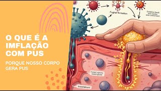 O que causa inflamação com pus  Porque nosso corpo produz pus [upl. by Cohlier751]