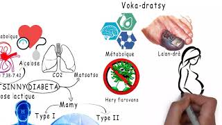 VOKADRATSINNY DIABETA Acidose lactique MG  Centre de Santé MAHEFA [upl. by Tammi]