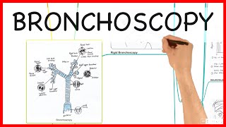 BRONCHOSCOPY  PRACTICAL CONDUCT SERIES [upl. by Eiten]