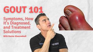 Gout 101 Symptoms How Its Diagnosed and Treatment Solutions [upl. by Airan]