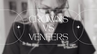 Cosmetic Crowns VS Veneers [upl. by Rico55]