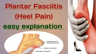 What is Plantar Fasciitis Heel Pain Treatment [upl. by Amaerd]