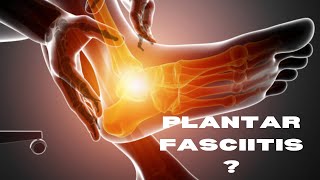 Plantar Fasciitis Causes Symptoms and Treatment [upl. by Anelej]