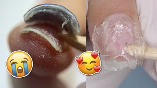 Damage FREE Soft Gel Nail Extensions Removal [upl. by Cookie]