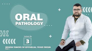 oral pathology  BENIGN TUMORS OF EPITHELIAL TISSUE ORIGIN2 [upl. by Ocirderf]