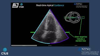 Realtime scanning assistant in echocardiography  NTNU 2023 [upl. by Dare]