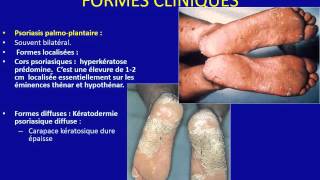 DERMATOLOGIE PSORIASIS [upl. by Adrienne285]