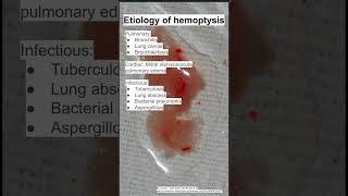 Etiology of hemoptysis [upl. by Yug511]