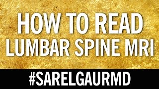 How To Read Lumbar Spine MRI Axial Anatomy [upl. by Kazue]