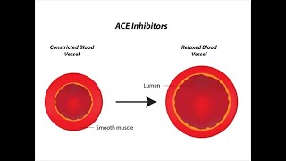 ACE inhibitors mechanism of action in hindi  Pharmacology  Nursing amp Pharmacy  Bhushan Science [upl. by Dewhirst]