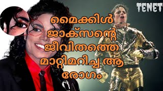 The disease that changed Michael Jacksons life TENETMALAYALAM [upl. by Hedgcock]