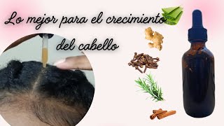 REMEDIO CASERO PARA CRECER EL CABELLO MÁS RÁPIDO [upl. by Canfield856]