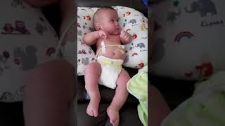 Focal Seizure in BabyInfant [upl. by Kassity]