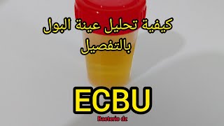 ECBU طريقة تحليل عينة البول بالتفصيل [upl. by Areip]