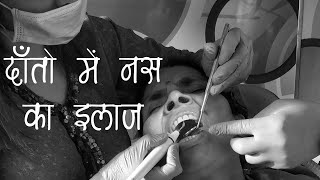 दाँतो में नस का इलाज  Root Canal Treatment in Hindi  Healthyho [upl. by Niliak]