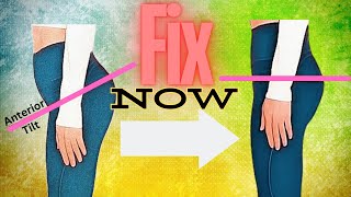 Anterior Pelvic Tilt FIX  No more Lower back Pain and Protruding Belly [upl. by Nawak]