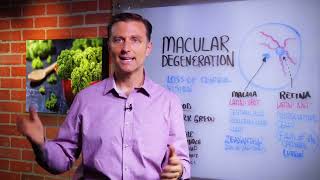 How To Prevent Macular Degeneration – Dr Berg [upl. by Nosemyaj249]