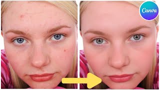 Face Retouching  Best Canva Tutorial  Skin Retouching  Canva for beginners [upl. by Lamraj]