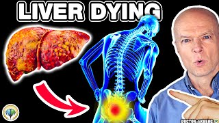 10 Weird Signs You Already Have LIVER DAMAGE [upl. by Castro283]