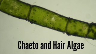 Reef Tank Microscopy Ep3  Chaeto and Hair Algae [upl. by Harlow]