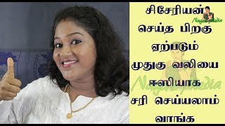 Back pain exercise after c section in tamilCesarean delivery back pain relief in tamil [upl. by Hahseram438]