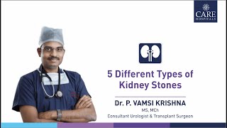 5 Different Types of Kidney Stones  Dr P Vamsi Krishna  CARE Hospitals [upl. by Ocinemod844]