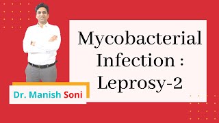 Mycobaterial Infection Leprosy Part 2  Hansens disease  Dermatology By Dr Manish Soni [upl. by Estus]