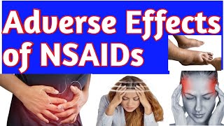 Antiinflammatory NSAIDs Drugs Adverse Effects Side Effects of NSAIDs Pharmacology pharmacist [upl. by Trelu]