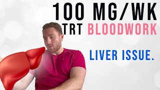 My Blood Work on 100mg Testosterone per Week [upl. by Dyke]