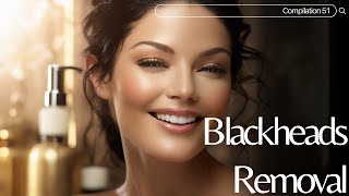 Skincare  Blackheads Removal 051 skincare skincare blackheads blackheads skincare [upl. by Matronna]