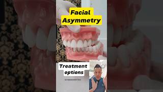 Facial Asymmetry Treatment What Are Your Options dentallan dentist shorts [upl. by Rosalynd]