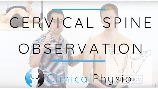 Cervical Spine Observation  Clinical Physio Premium [upl. by Roberta]