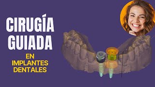 👌Colocación de Implantes Dentales de forma Precisa y Rápida  Dr Ivan Meza culiacan [upl. by Ethelred822]