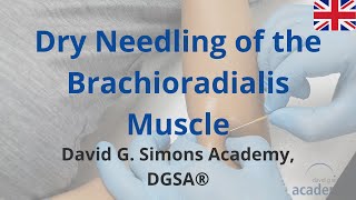 How to treat the Brachioradialis Muscle with Dry Needling  David G Simons Academy DGSA® [upl. by Keligot]