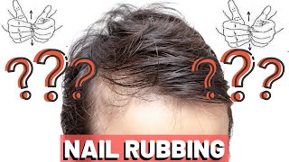 NAIL RUBBING For Hair Growth  FACT or FICTION [upl. by Moore]