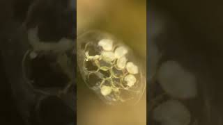 Ramshorn snail hatching SnailHatching AquariumSnails RamshornHatch SnailEggs AquariumLife [upl. by Huff]