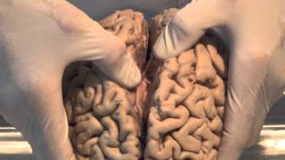 Introduction Neuroanatomy Video Lab  Brain Dissections [upl. by Oulman]